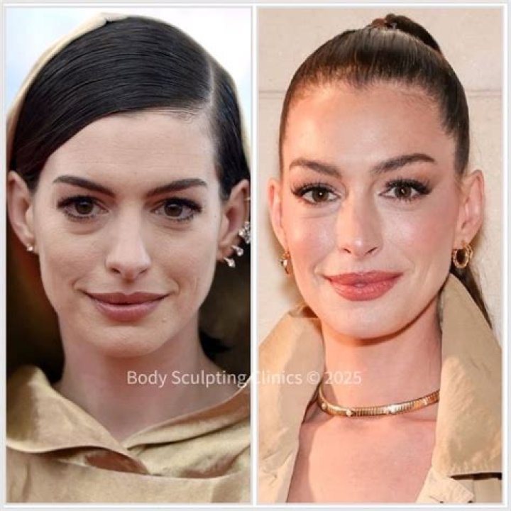 
How Much Money Does Anne Hathaway Make? Latest Income Salary
