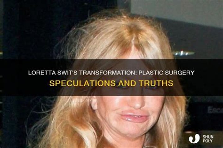 Loretta Swit Plastic Surgery: Loretta's Altered Appearance Went Wrong?