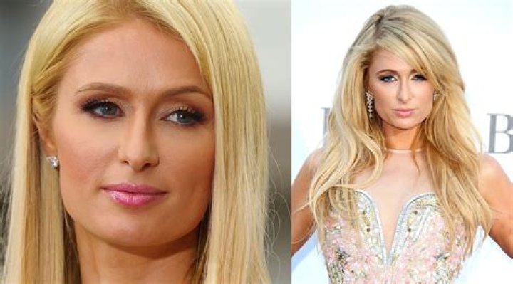Paris Hilton Nose Job Plastic Surgery Before and After