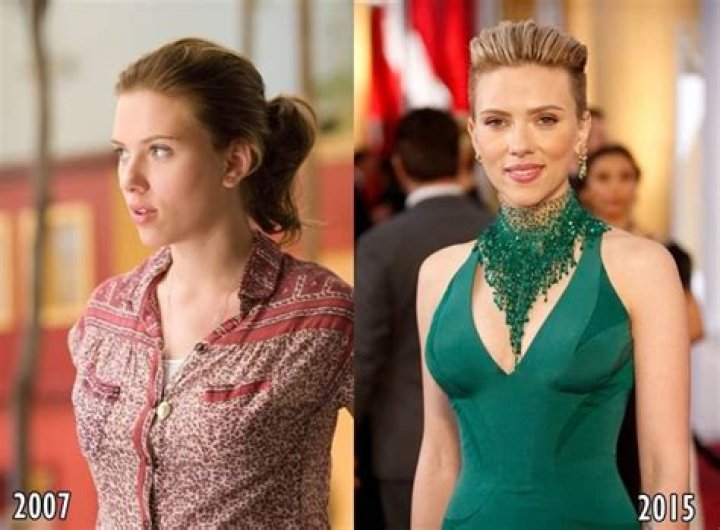 Scarlett Johansson Breast Reduction Plastic Surgery Before and After
