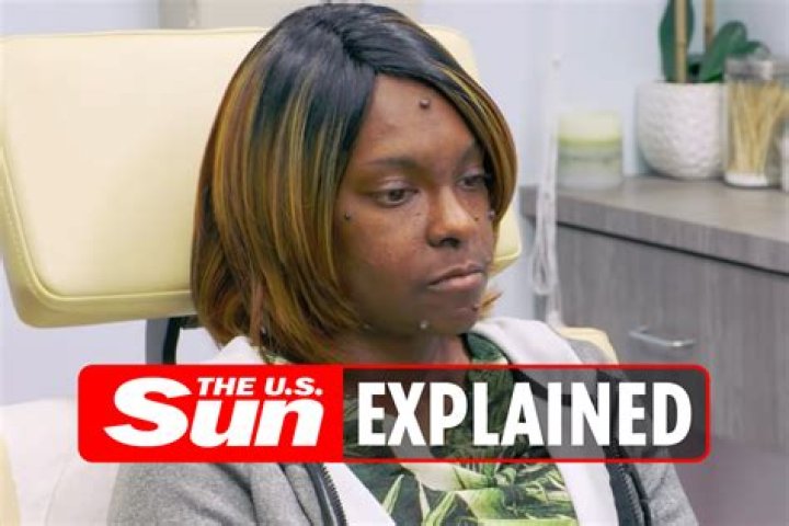Who Was Brittany Sharp On Dr. Pimple Popper? – Celebrity
